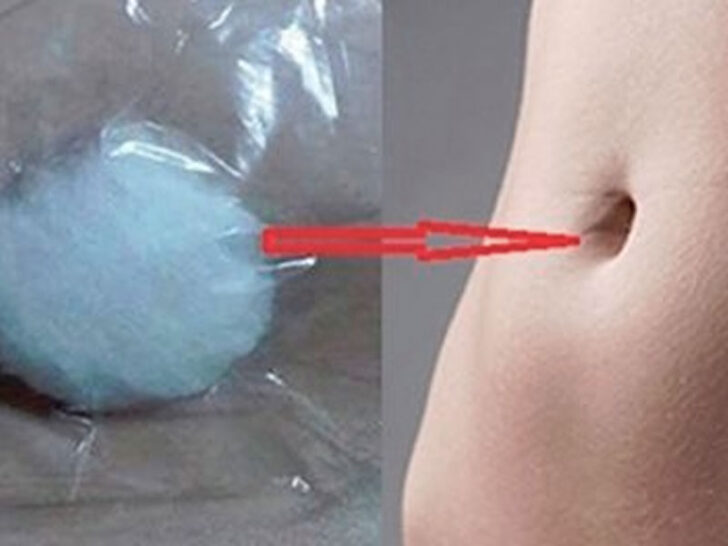 Algodón con alcohol en el ombligo para la tos Algodón con alcohol en el ombligo para la tos